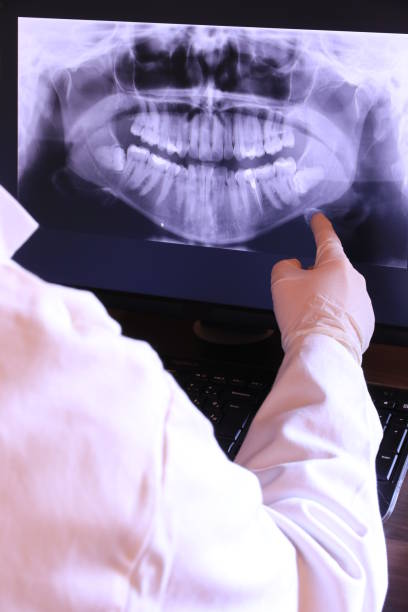 Best Emergency Tooth Extraction in Spruce Pine, NC