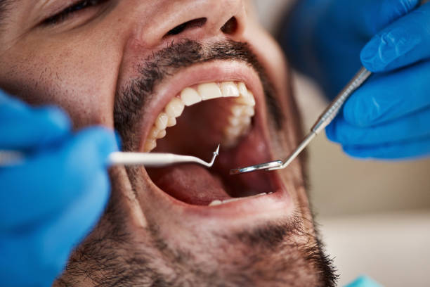 Best Walk-In Emergency Dentist in Spruce Pine, NC